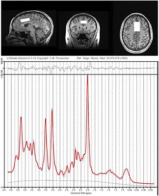 Higher Levels of Pro-inflammatory Cytokines Are Associated With Higher Levels of Glutamate in the Anterior Cingulate Cortex in Depressed Adolescents